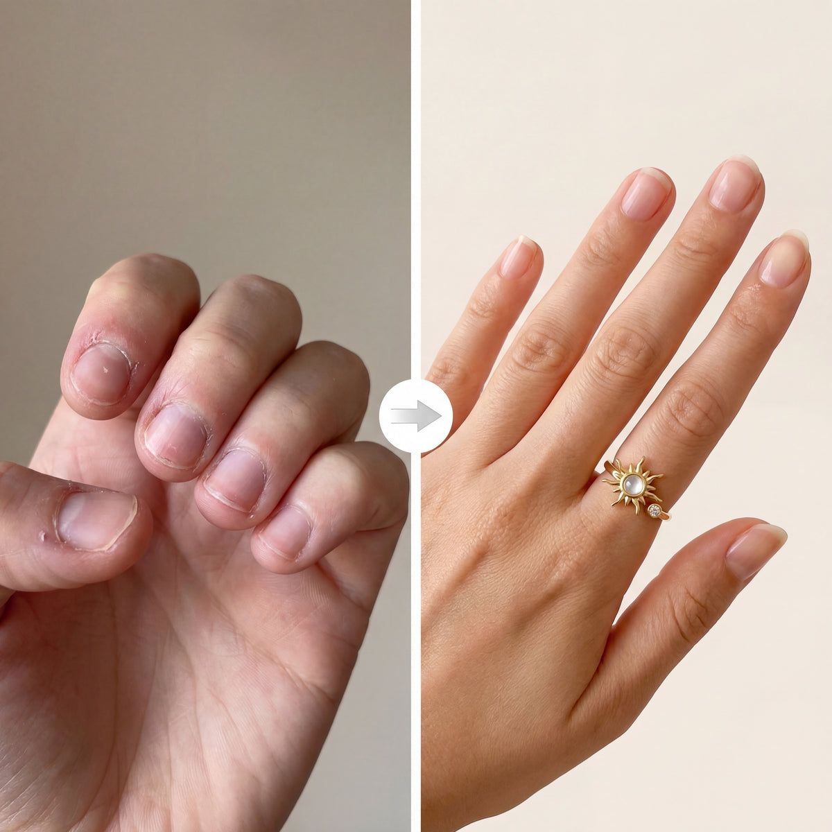 Zklidněte ruce během pár sekund.