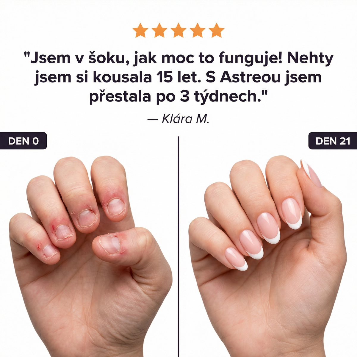 Zklidněte ruce během pár sekund.